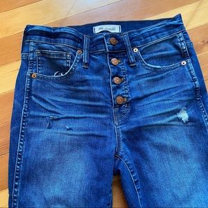 Madewell Button Fly Skinny Jeans